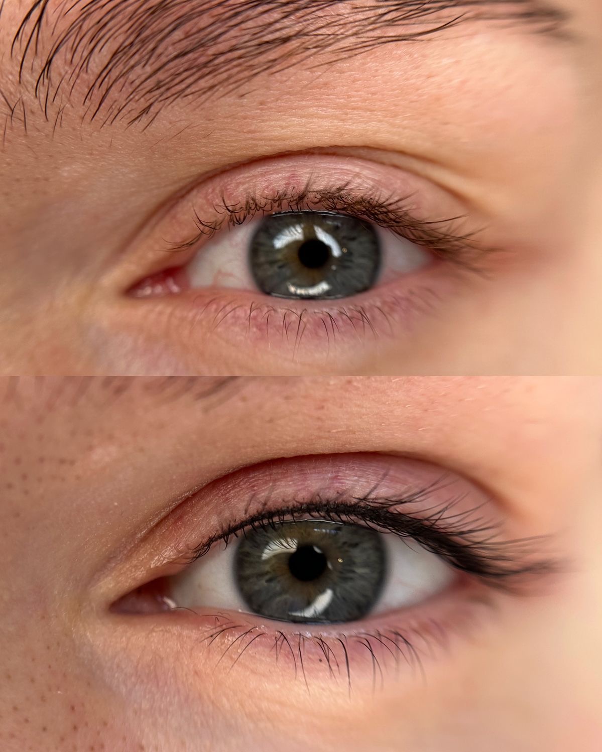 Lash line enhancement before and after