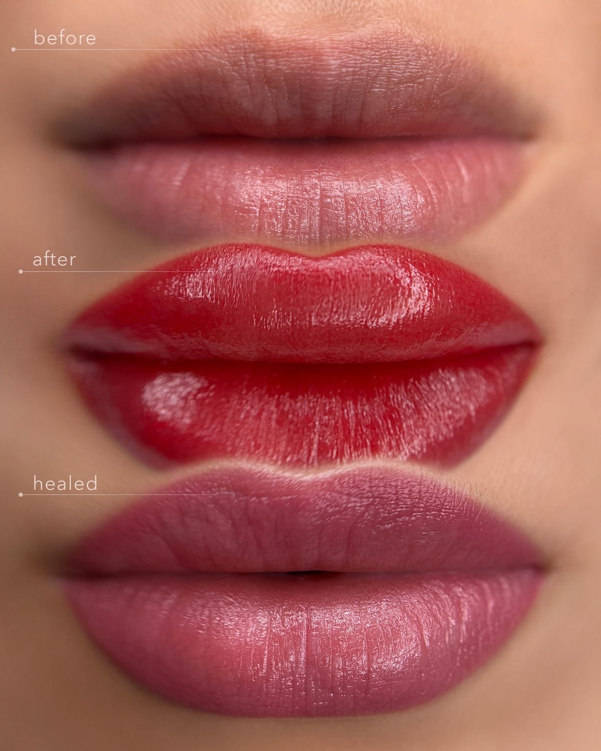 Lip blush before after and healed results